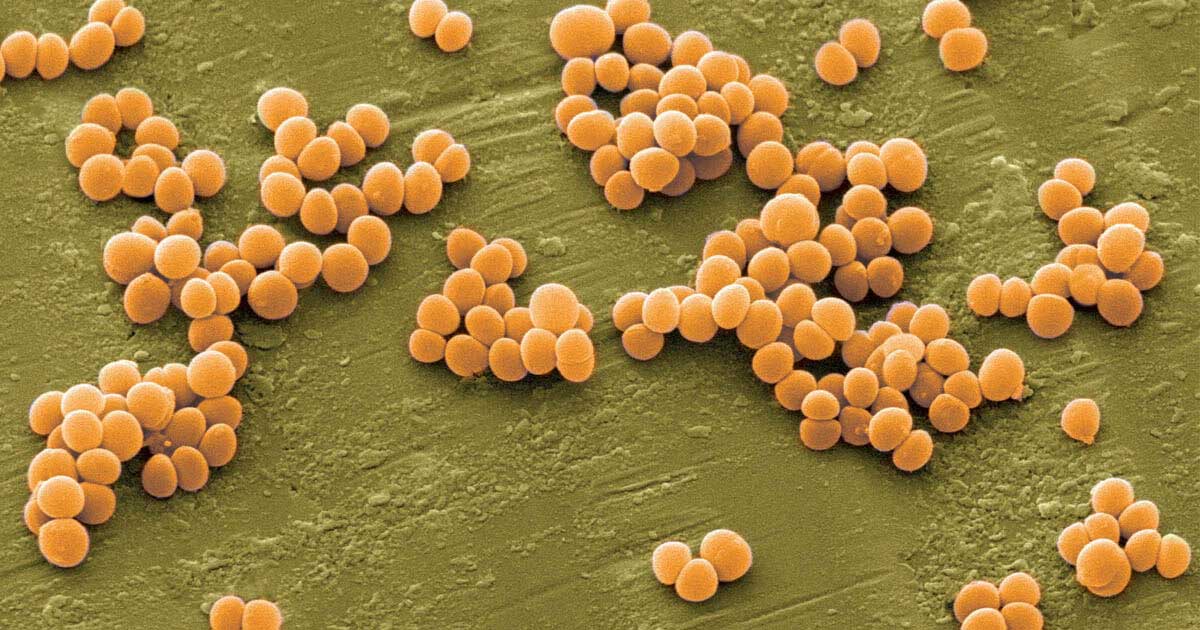 Vi khuẩn Staphylococcus aureus